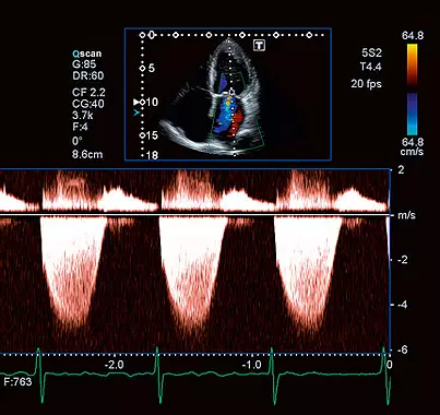 d9fa75_b05447e0ecca41bcbc60316eae189a96_mv1 duplex scan