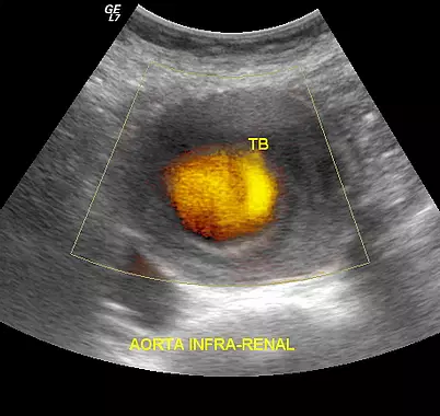 duplex scan duplex scan